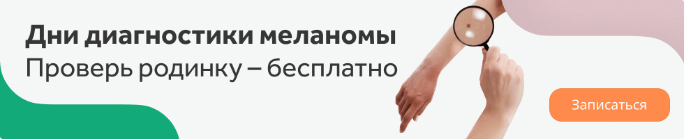 Диагностика меланомы