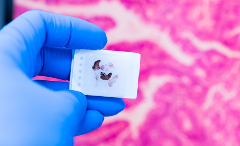 Биопсия с гистологическим анализом