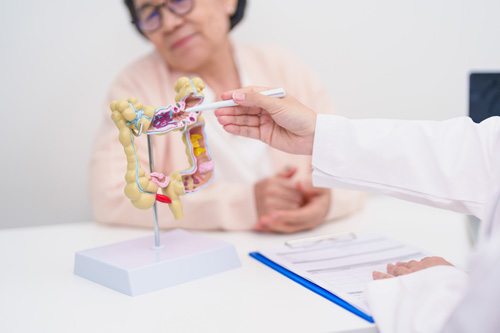 колоректальный рак