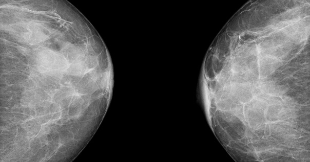 Солидный рак