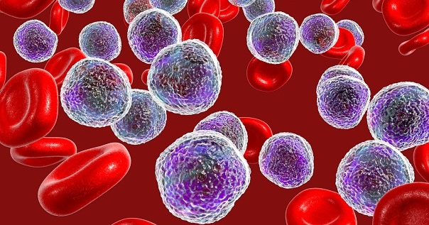 IV стадия рака