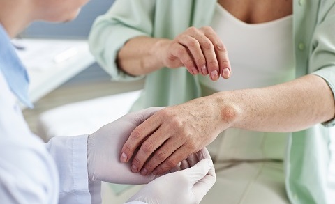 Виды болезни Боуэна