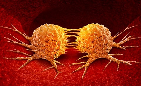 Принцип и пути метастазирования Принцип и пути метастазирования