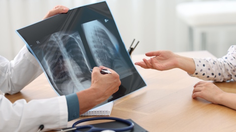 Методы диагностики плоскоклеточного рака легких