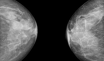 Солидный рак