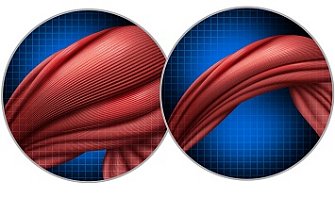 Злокачественная кахексия