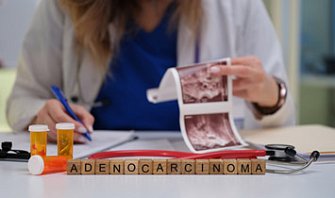 Аденокарцинома