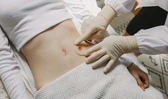 Стома при раке