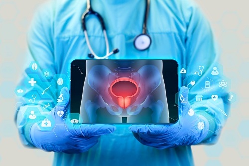 Рак простаты