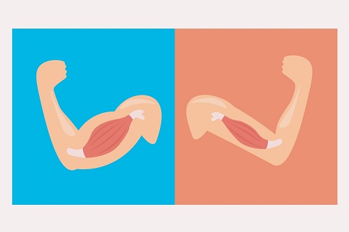 Кахексия при раке: определение и механизмы