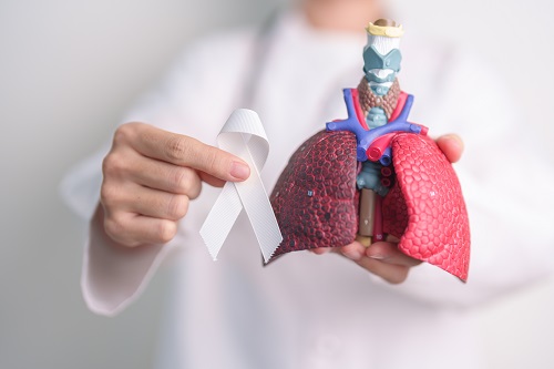 Рак легкого