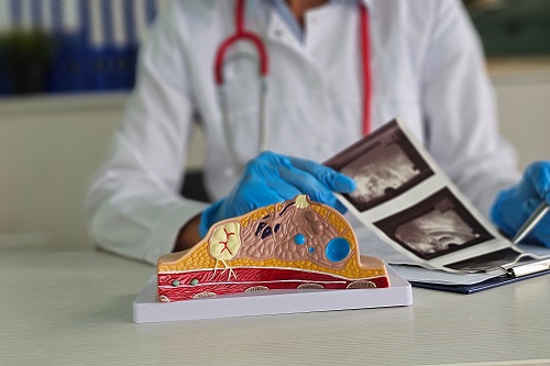 Когда необходим тест на HER2 Когда необходим тест на HER2